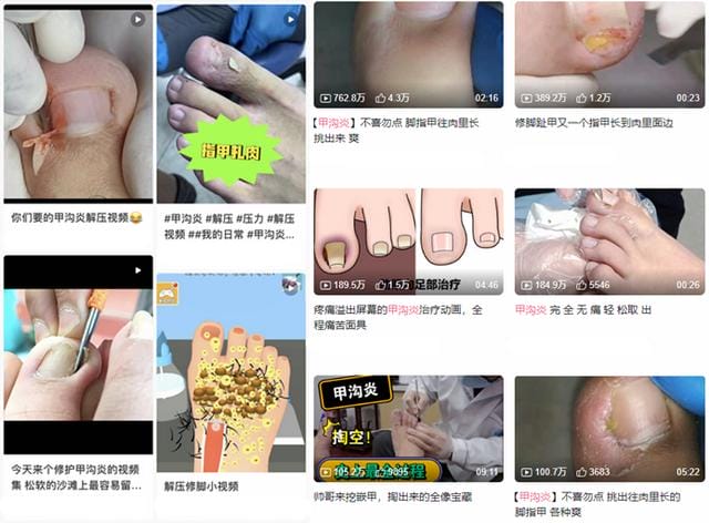 中国人的脚,赚钱得很
